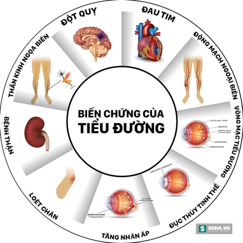 Lương y Đỗ Quý Hạnh - khắc tinh của bệnh tiểu đường và nhiều căn bệnh mãn tính khác